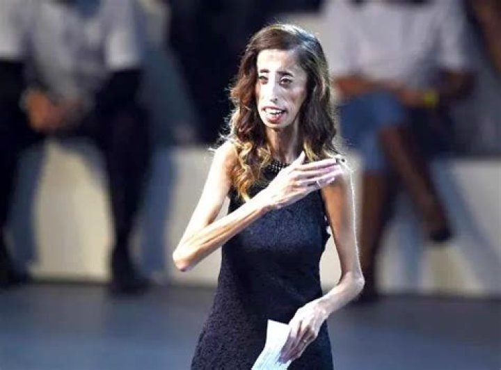 10 Skinniest Models on the