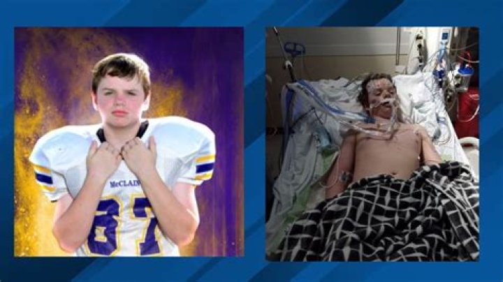 12YearOld Boy Dies After Collapsing in P.E. Class Family