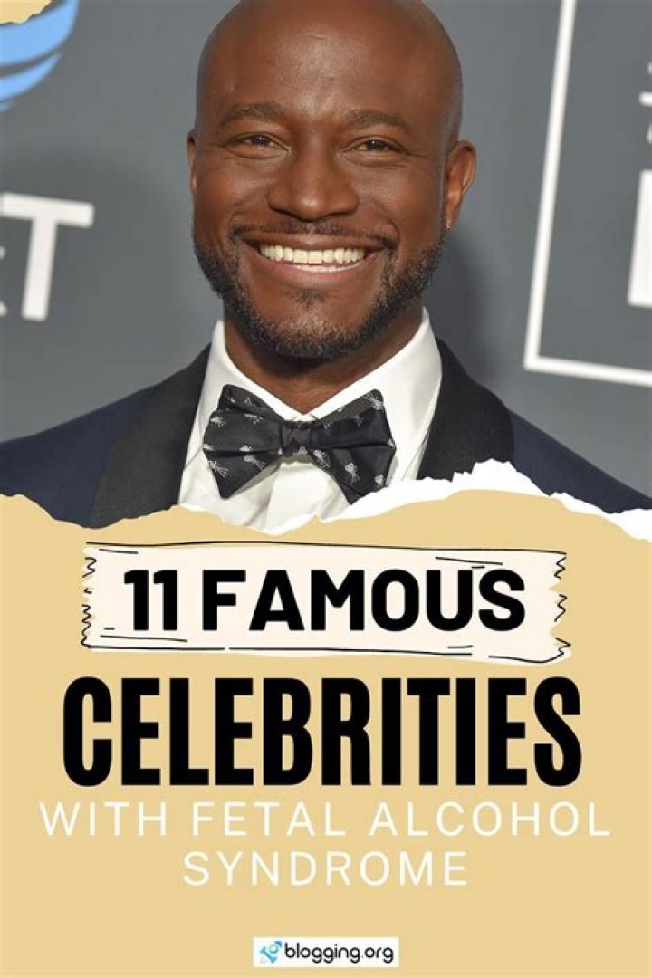 7 Celebrities With Fetal Alcohol Syndrome Oasis Recovery Center