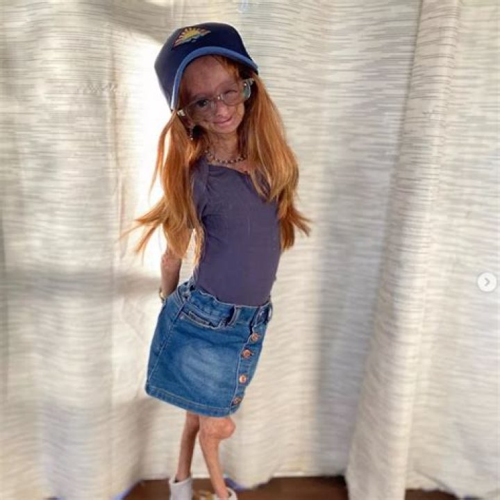 Adalia Rose: The Inspiring Journey Of A Young Star