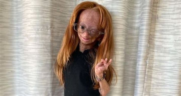 age adalia rose did adalia rose pass away Dadane