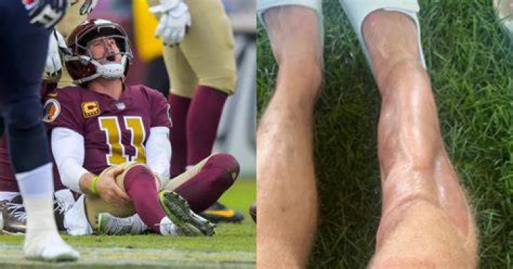 Alex Smith injury update Out of hospital, NFL future uncertain