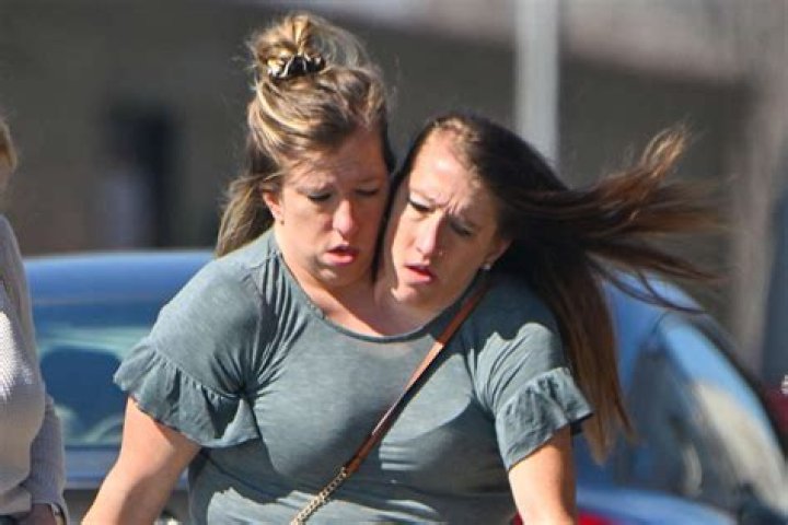 Are abby and brittany hensel conjoined twins married legsbm