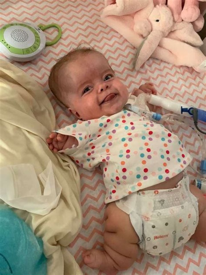 Baby with rare dwarfism is home after 184 days in hospital ABC News