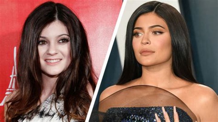 Before and after of Kylie Jenner. Kylie Before And After, Celebrities