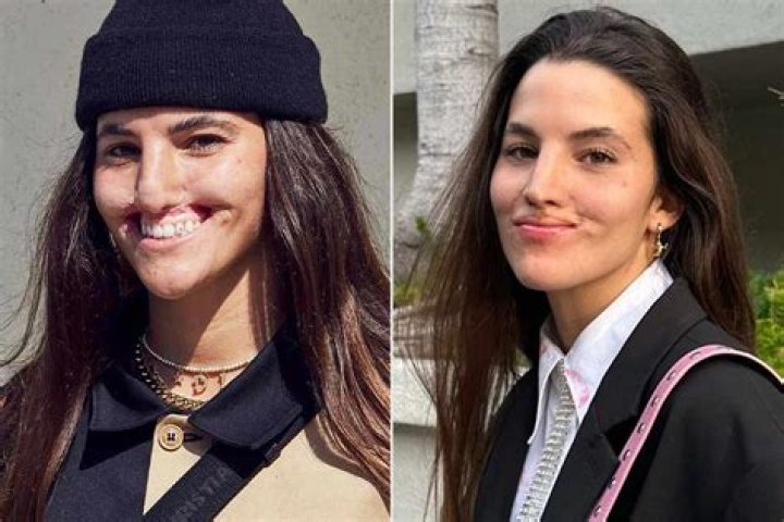 Brooklinn Khoury Shares BeforeandAfter Photos of Her Smile After Dog