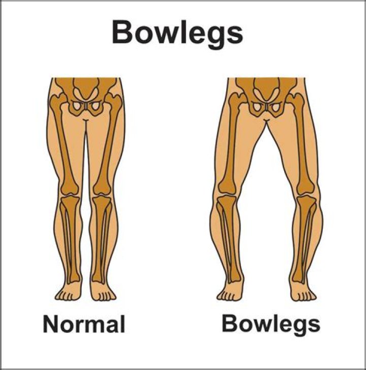 Cam Newton's Bow-Legged Younger Sibling: Intriguing Insight
