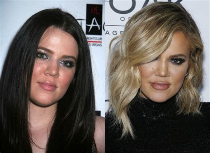 Celebrity Plastic Surgery 30 Before and After Photos StyleCaster