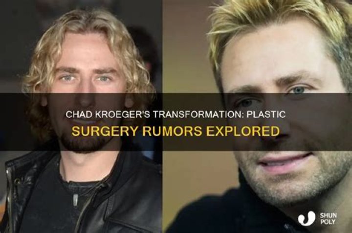 Chad Kroeger: The Transformation And Speculations Of Plastic Surgery