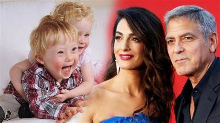 Clooney Twins Down Syndrome Ella And Alexander Health