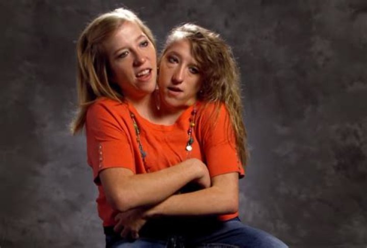 Conjoined Twin Sisters Abigail And Brittany Hensel Ha vrogue.co