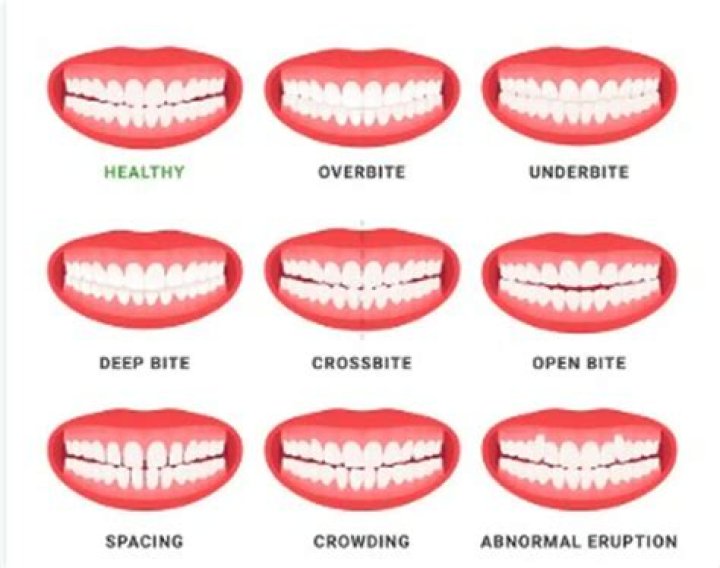 Crooked Smile: A Celebration Of Imperfections