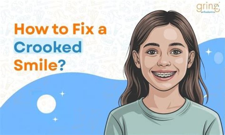 Crooked Smile When You Should Own It, Or Fix It Newpark Orthodontics