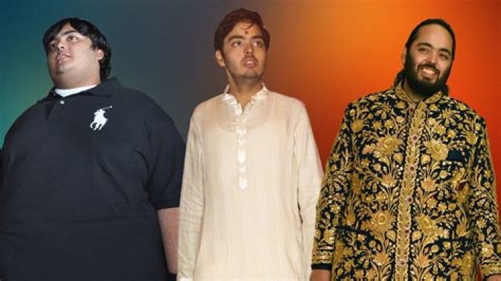 Did Anant Ambani Undergo Weight Loss Surgery Or Not? Health Condition
