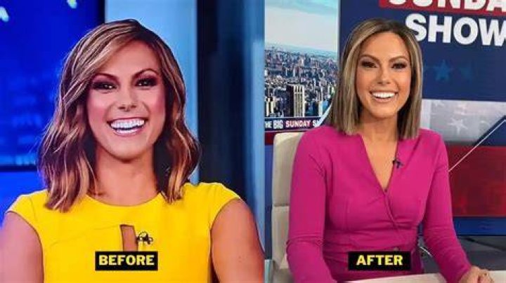 Did Lisa Boothe Undergo Plastic Surgery Including Boob Job, Nose Job
