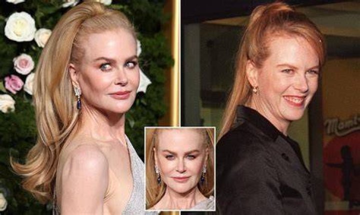Did Nicole Kidman Have Plastic Surgery? See Transformation