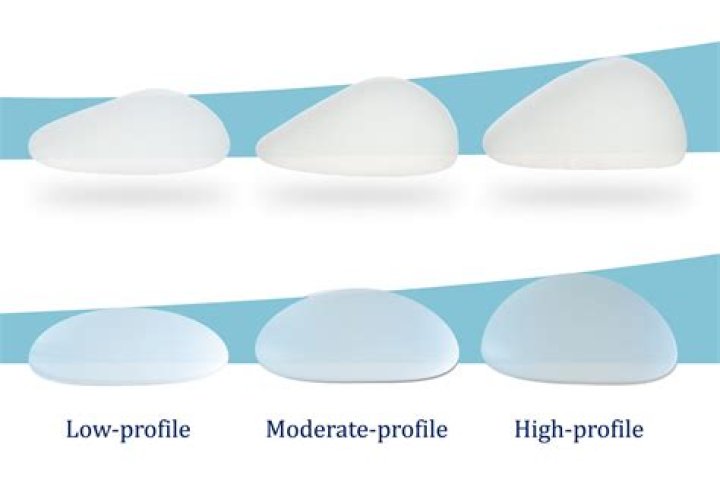 Dissecting Sabrina Carpenter's Breast Implants: A Detailed Analysis