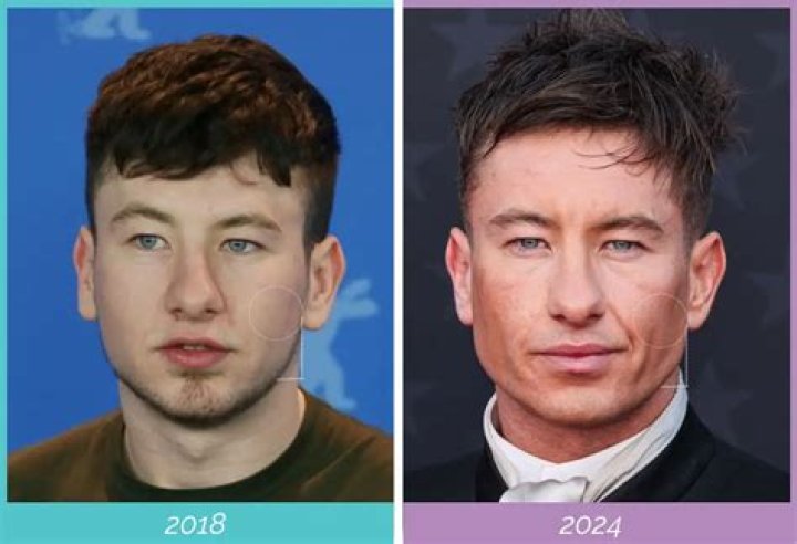 Exploring Barry Keoghan's Ethnicity: A Deep Dive