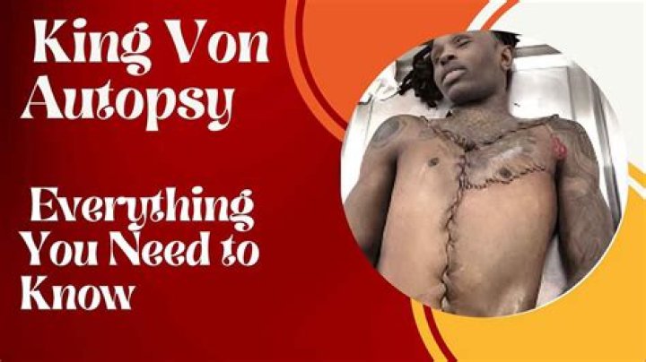Exploring The Depths Of King Von's Legacy: Imagining His Autopsy