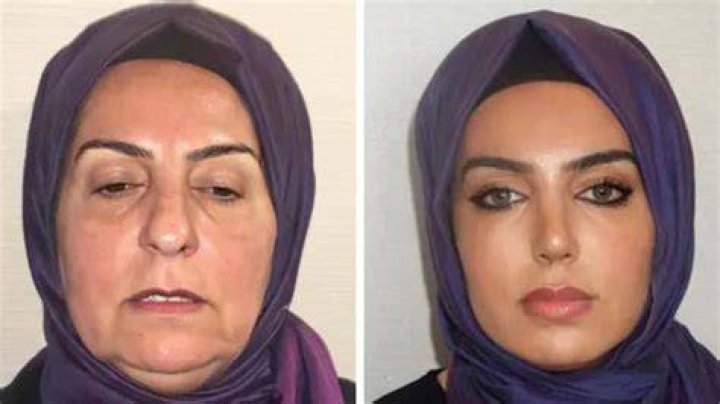Exploring The Truth: Has Tyla Had Plastic Surgery?