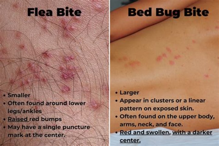 Fight Bug Bites With LaShawn Johnson's Bed Bug Expertise