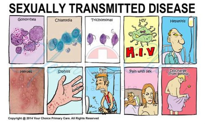 Five diseases you can get from kissing