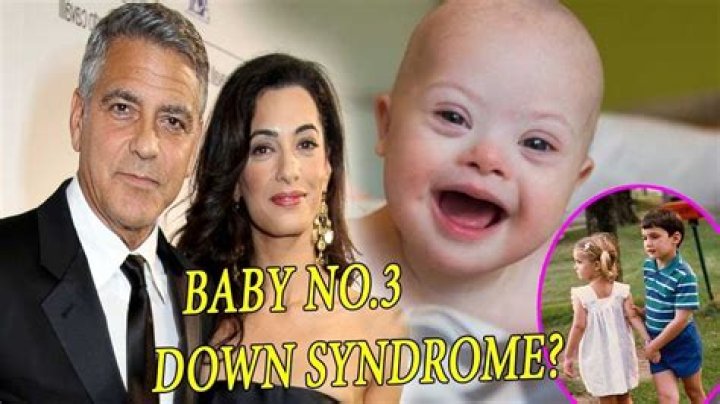 George Clooney's Journey With Children: Love, Acceptance, And Down Syndrome