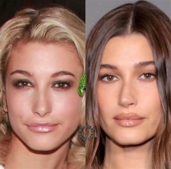 Hailey Baldwin slams plastic surgery rumors 'I've never touched my face'