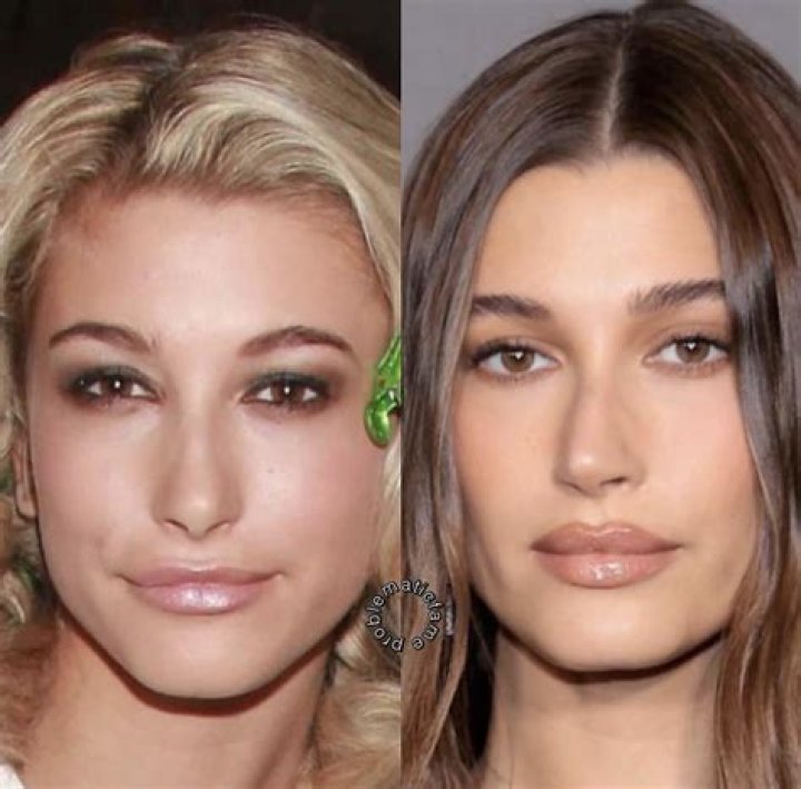 Hailey Bieber Before & After Beauty Transformation ELLE Australia