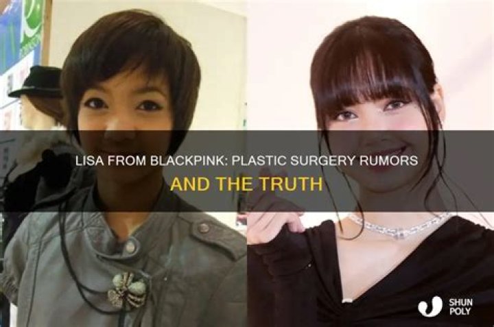 Has Lisa Had Plastic Surgery? Transformation Photos Life & Style