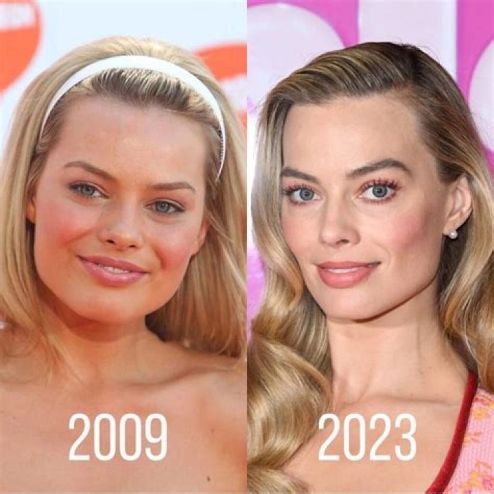 Has Margot Robbie had cosmetic surgery? MYA Cosmetic Surgery