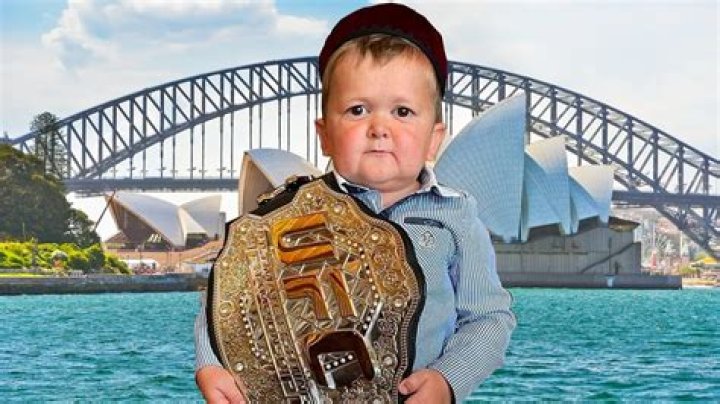 Hasbulla is Coming to Australia, Tour Details Announced Man of Many