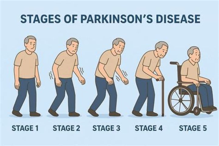 How Long Does Parkinson's Disease Last