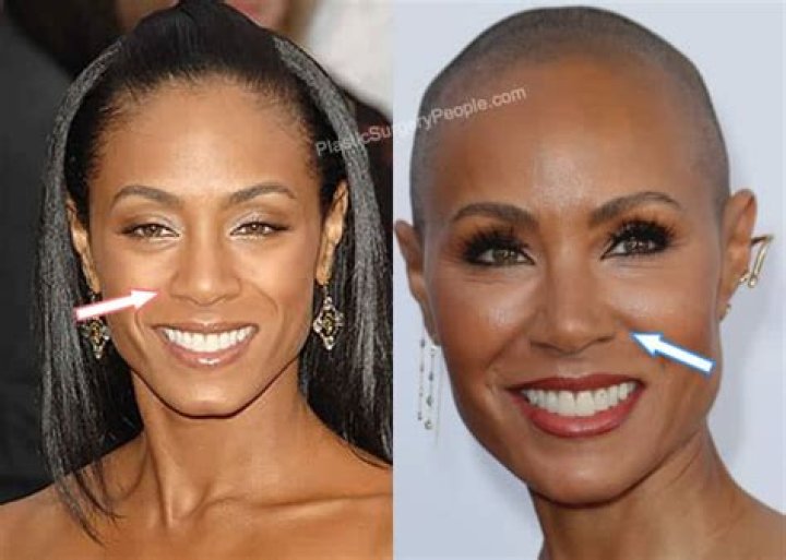 Jada Pinkett Smith Plastic Surgery. Did she had to do it?