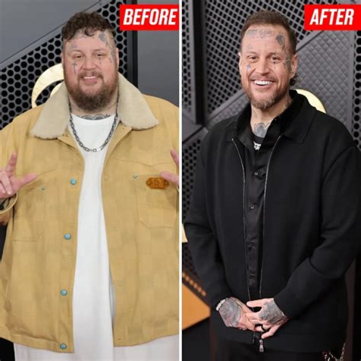 Jelly Roll Weight Loss Photos Before And After