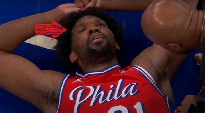 Joel Embiid Blinking Only One Eye Facial Paralysis After Reinjuring His