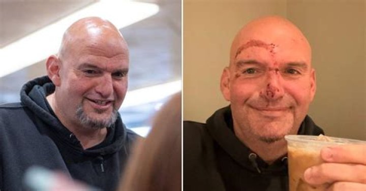 John Fetterman has been off the campaign trail since May. As Senate