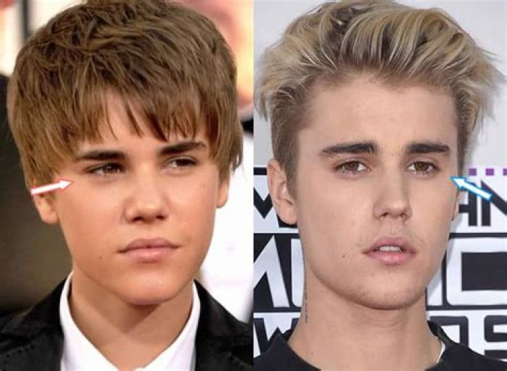 Justin Bieber, Before and After Transformation 2018!