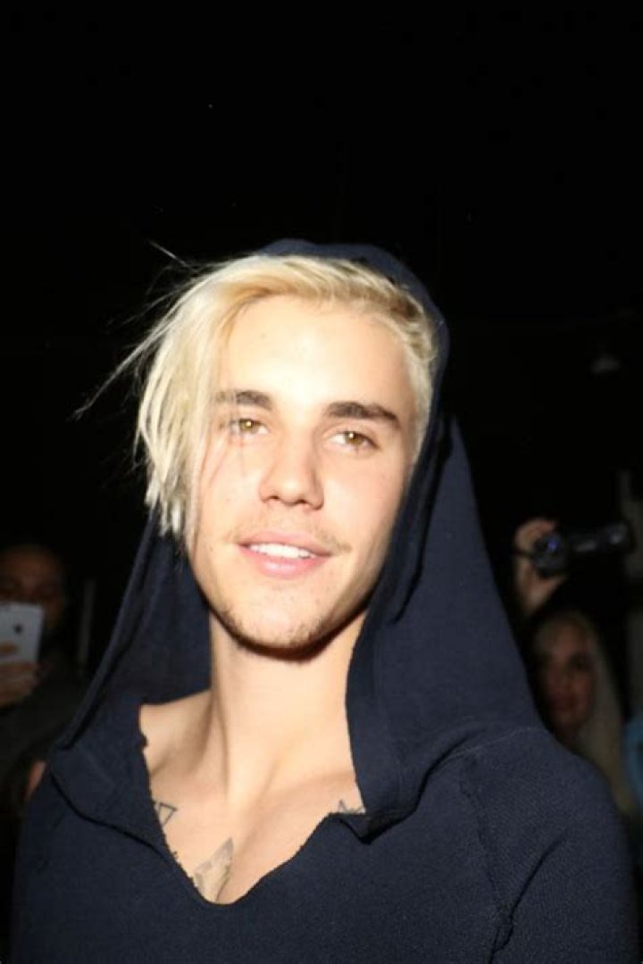 Justin Bieber Hair Loss What Occurred? Cibiotix Health Information