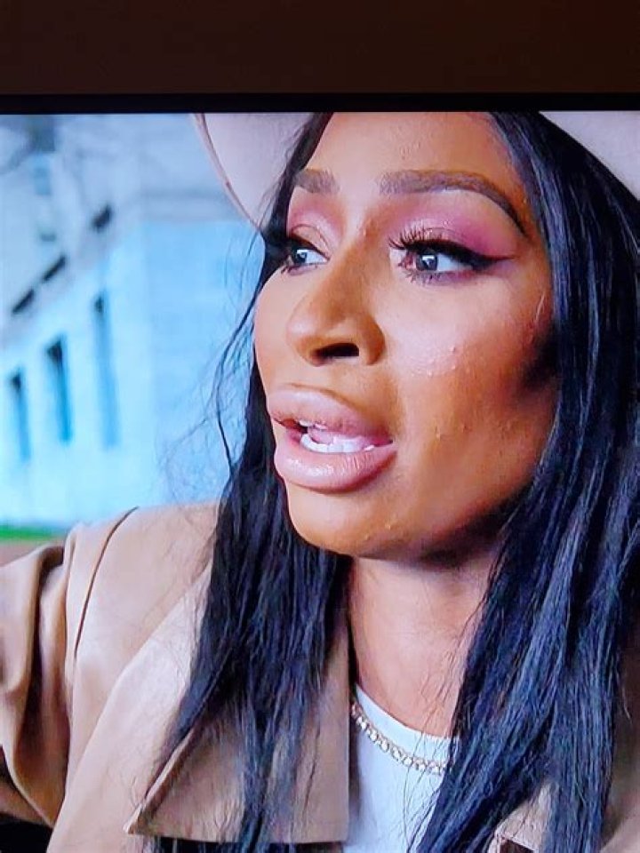 Karlie Redd Publicly Addresses Cosmetic Surgery Rumors 'Let's Keep It