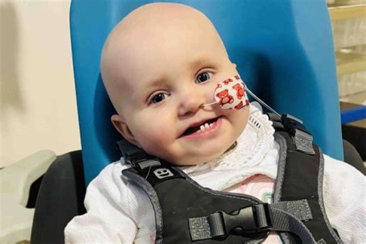 Kentucky baby diagnosed with rare form of dwarfism ABC7 San Francisco