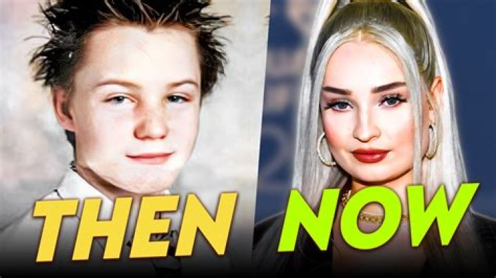 Kim Petras Before & After Her Full Transformation Realtime YouTube