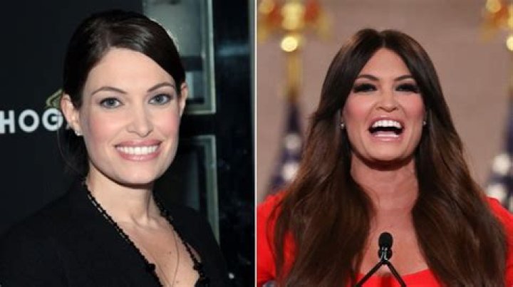 Kimberly Guilfoyle before and after plastic surgery 03 Celebrity