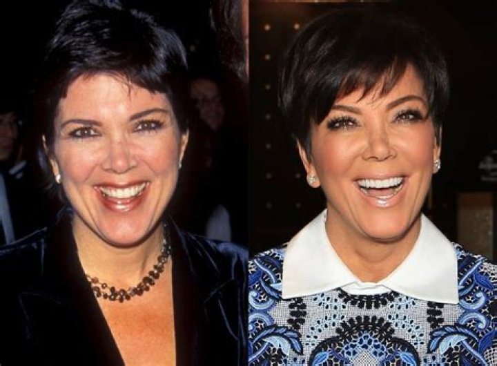 Kris Jenner perfect plastic surgery for 59 years old mother!
