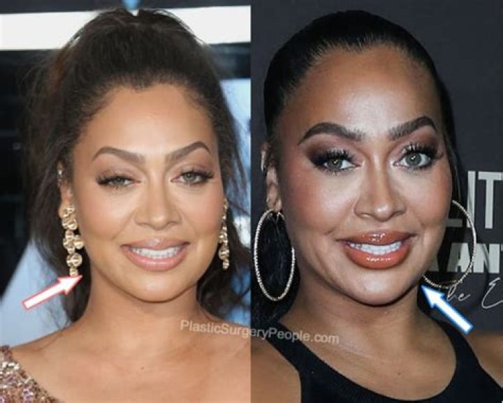 Lala Anthony, BEFORE and AFTER 2022