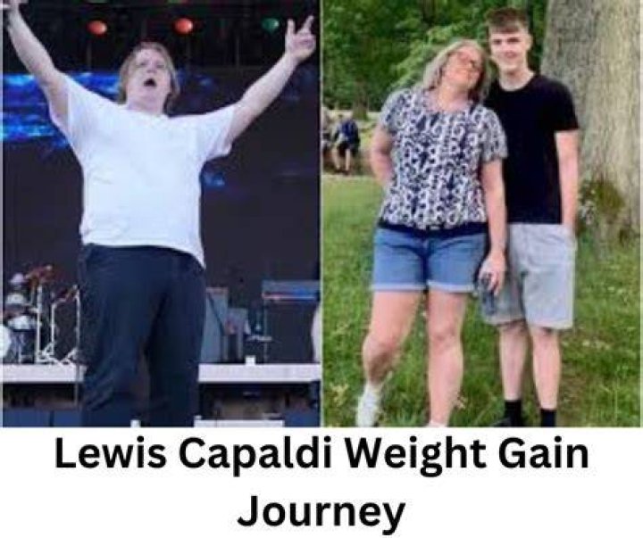 Lewis Capaldi&rsquo;s Weight Gain in 2023 The Singer Looks Way Too Heavier!