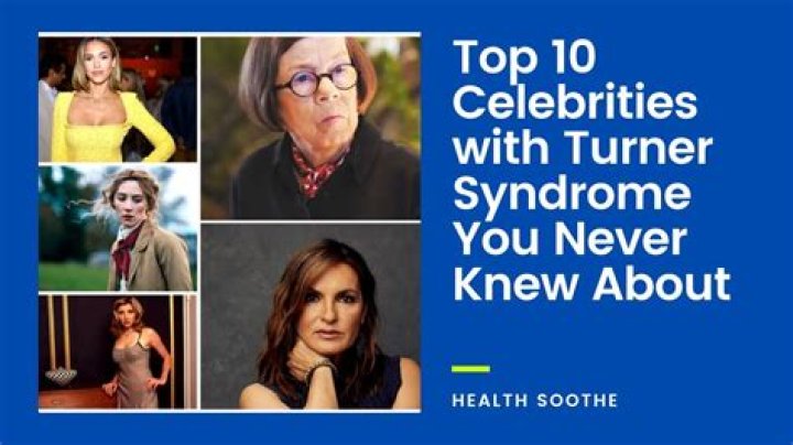 List of Celebrities With Turner Syndrome Public Health