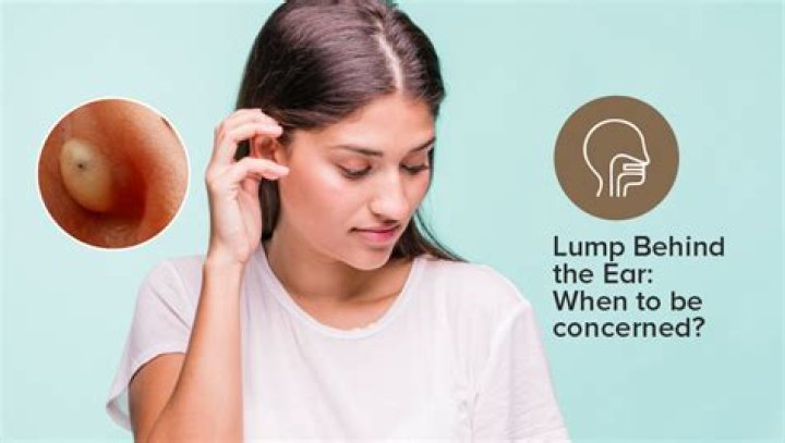 Lumps Behind the Ear 6 Causes & When to See a Doctor Tua Sa&uacute;de