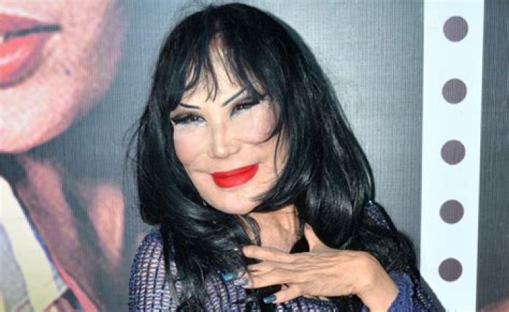 Lyn May y su rostro antes de las cirugías El Diario NY