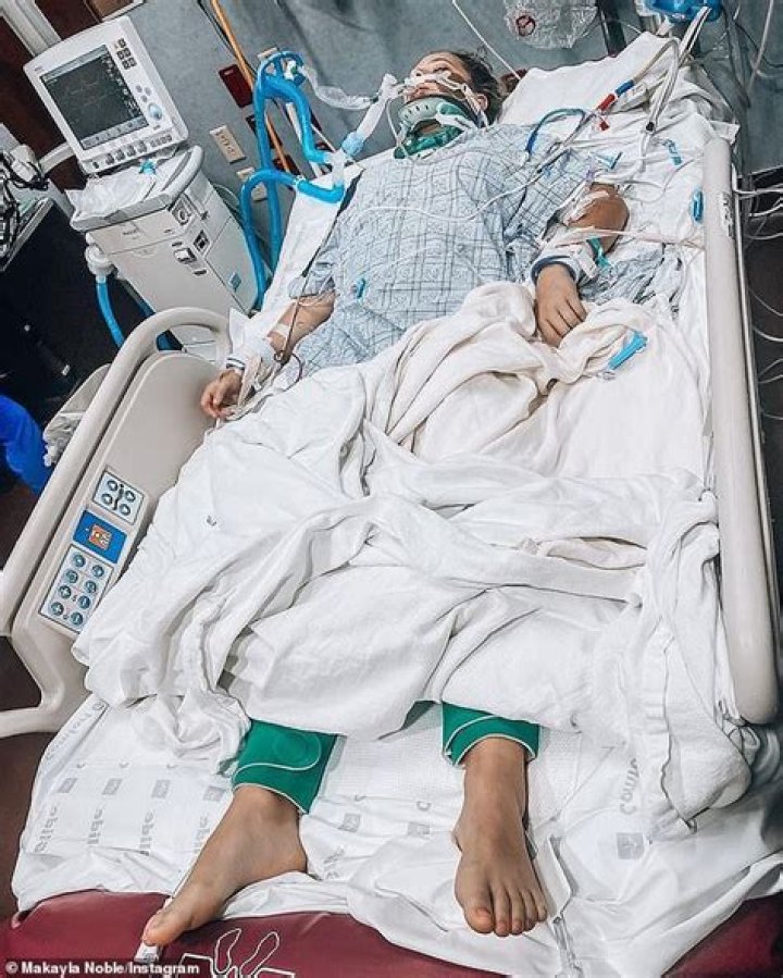 Makayla Noble Accident Story What Happened To Her? Injury And Health